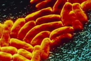 Nova opasnost po zdravlje: Otkrivena superbakterija otporna na...