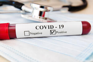 U SAD od koronavirusa umrlo još 382 ljudi