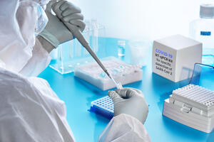 Nabavili PCR testove za 790.000 eura