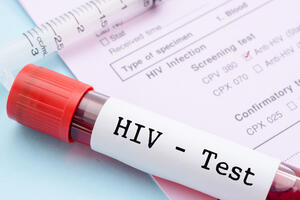 CAZAS: U četvrtak besplatno testiranje na HIV i hepatitis B i C u...