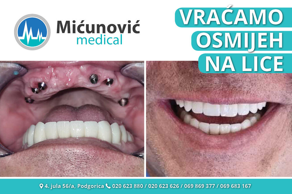 Mićunović medical