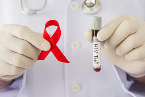 Juventas: Testirajte se na HIV besplatno i anionimno