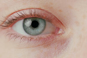 Mogu li kortikosteroidi uticati na vid?