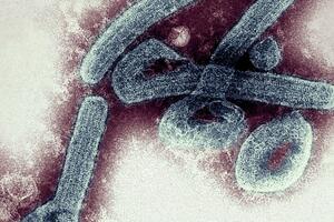 U Gani potvrđena prva dva slučaja smrtonosnog Marburg virusa