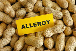 Kikirikijem protiv alergije na kikiriki