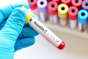 Procjenjuje se da 320 miliona ljudi širom svijeta ima hepatitis B...