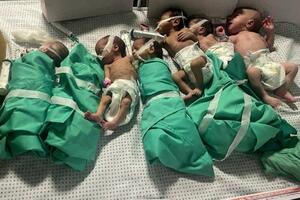 BBC: Kako prijevremeno rođene bebe preživljavaju poslije...