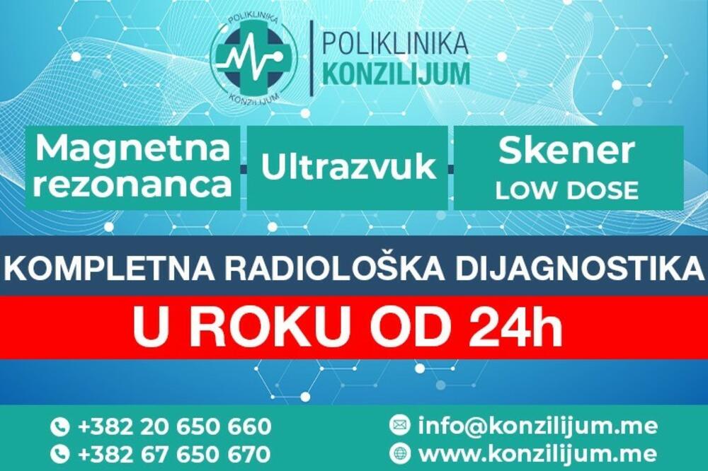 Foto: Poliklinika Konzilijum