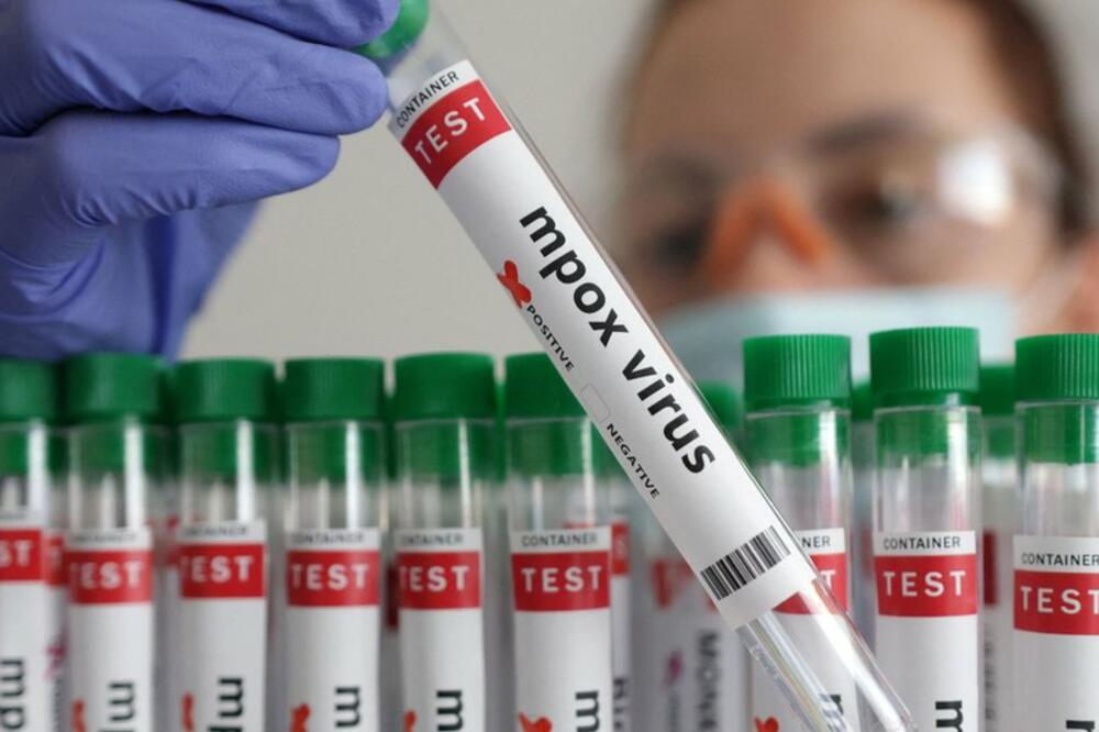 Test na "virus majmunskih boginja", Foto: Reuters