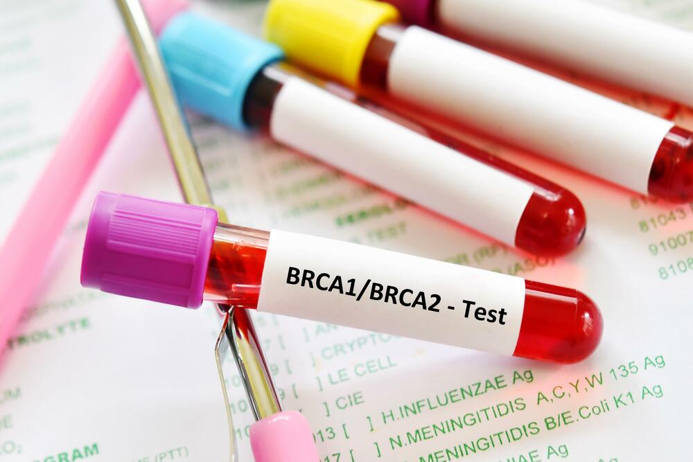 BRCA test