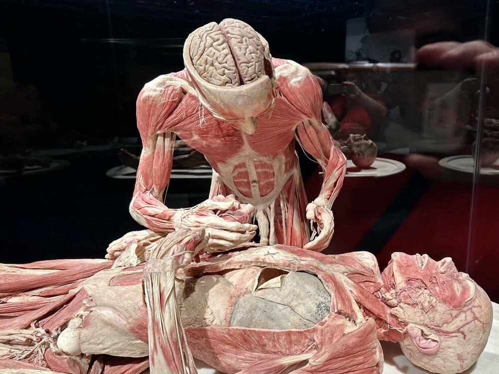 'Hirurg' - plastinat