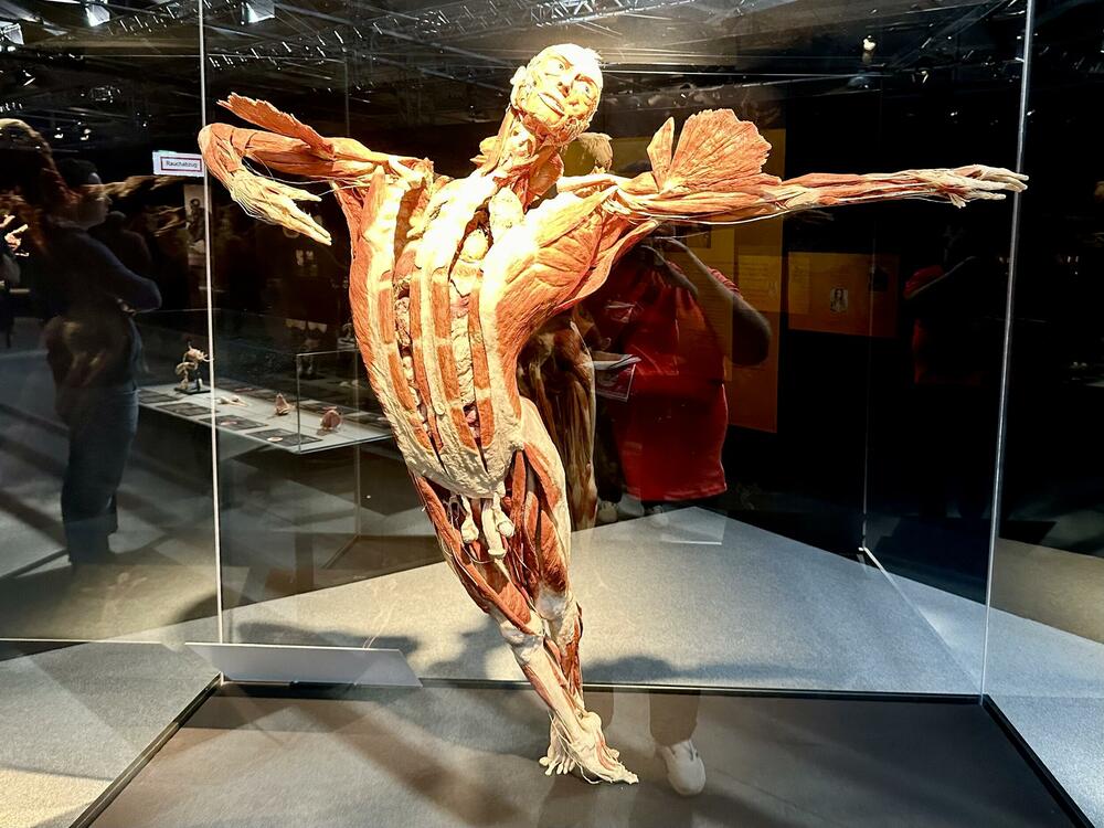 'Plesač' - plastinat