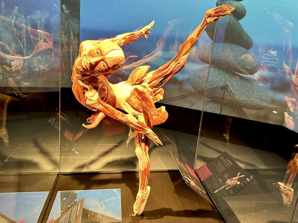 'Balerina' - plastinat