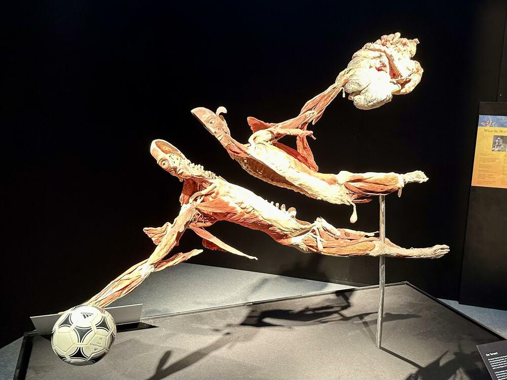 'Golman' - plastinat