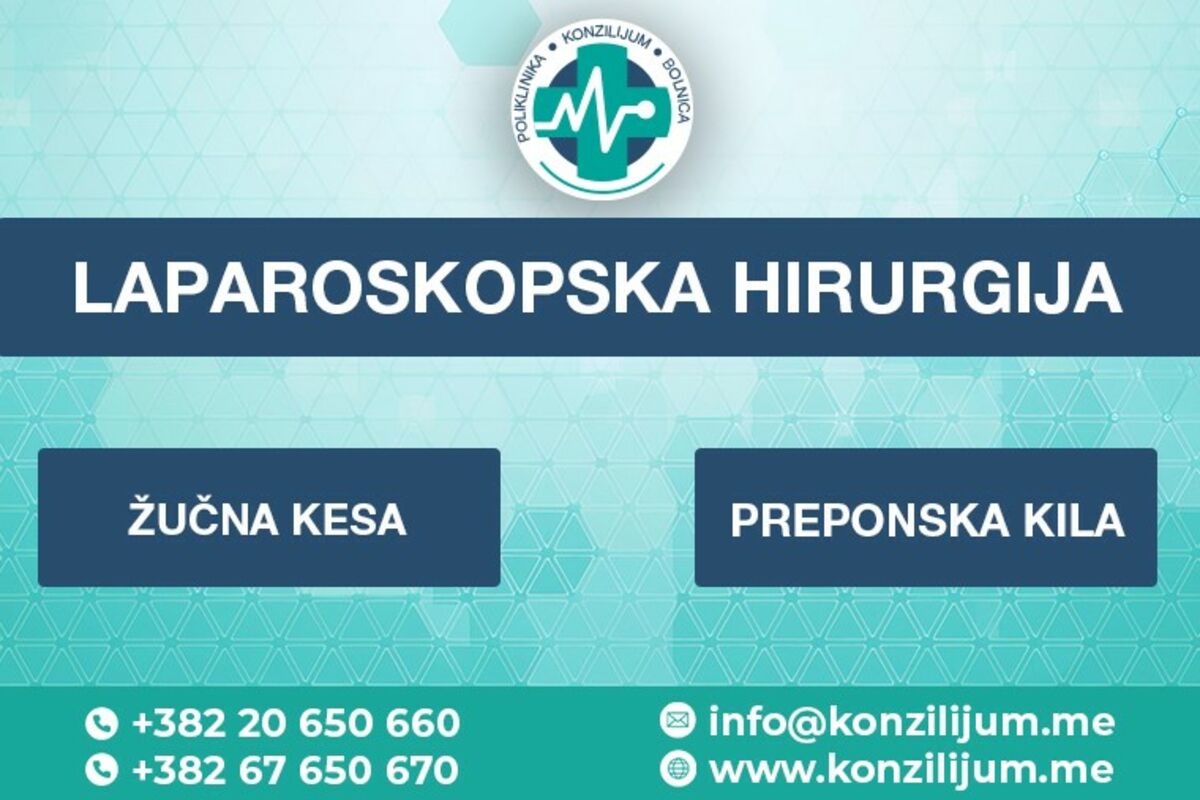 Laparoskopska hirurgija Poliklinika i bolnica Konzilijum kvalitetno i brzo rješenje uz lakši oporavak